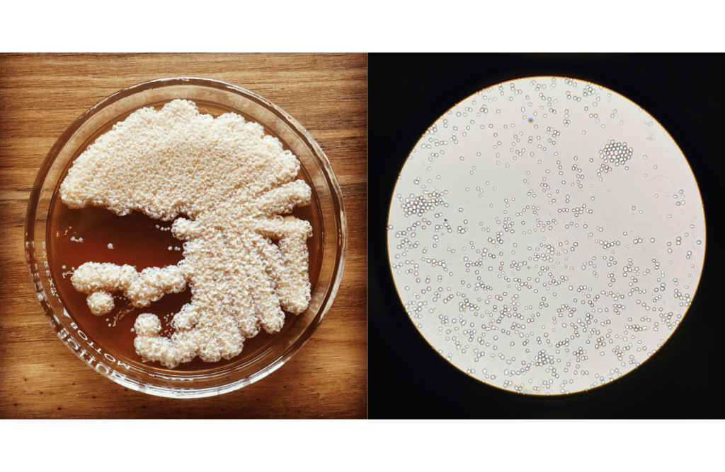 On the right: Yeast colonies gowing on an agar streak plate. On the left: yeast under a microscope at 400x magnification.