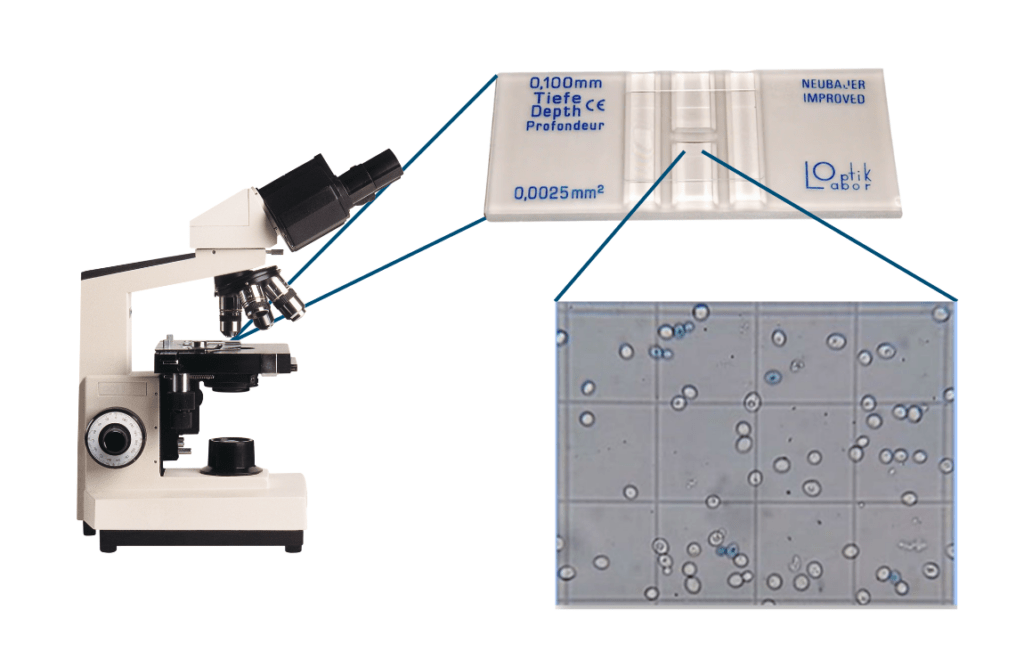 Photo of a microscope, hemocytometer, and close up of yeast on a hemocytometer
